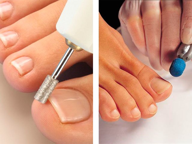 matériel informatique