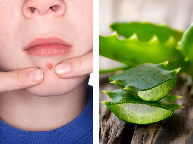 Masques avec aloès pour le visage à la maison