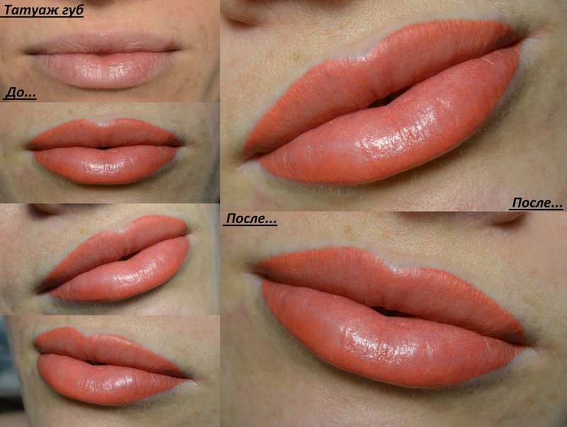 Photos avant et après le tatouage des lèvres Photos avant et après la procédure