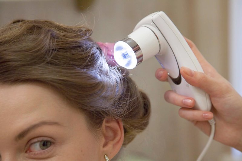 Diagnostics capillaires Diagnostics capillaires