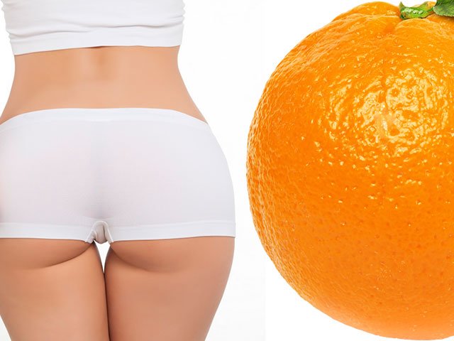 Méthodes pour se débarrasser de la cellulite Méthodes pour se débarrasser de la cellulite