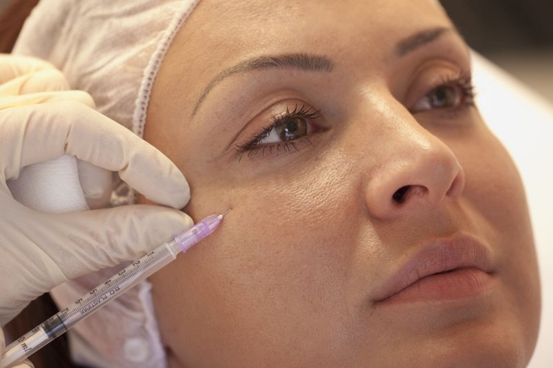 Injections de poches sous les yeux Injections de poches sous les yeux