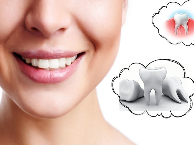 Un rêve de dents Un rêve de dents