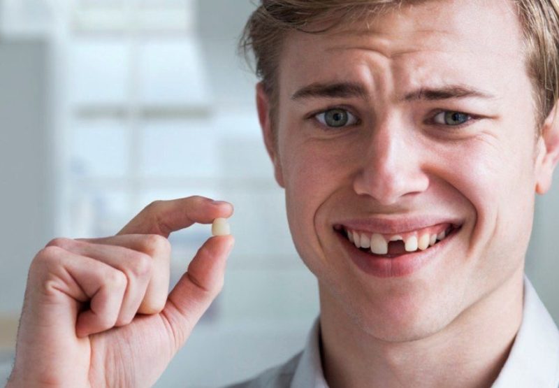 Dent tombée dans un rêve Dent tombée dans un rêve