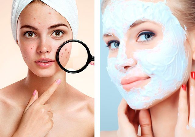 Masques contre l'acné Masques contre l'acné