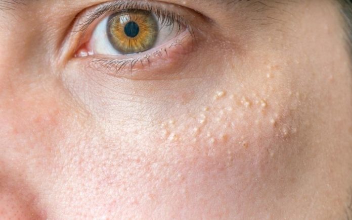 Jirovik Complot contre wen