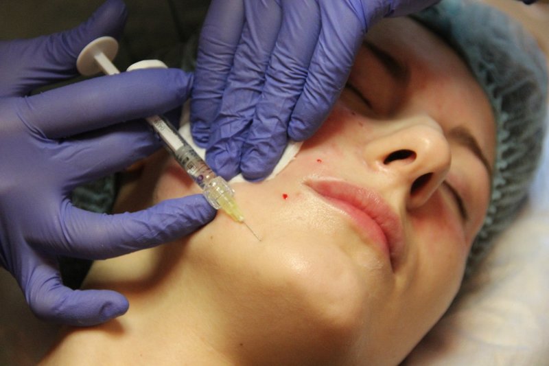 Traitement du bas du visage Traitement du bas du visage