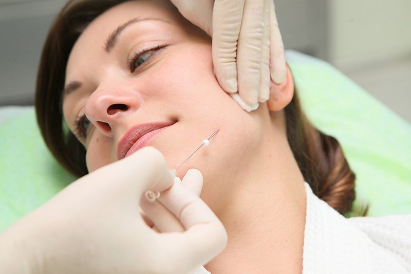 Fil de levage Fil de levage