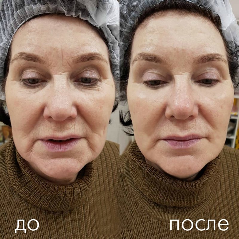 Efficacité de levage du matériel Efficacité de levage du matériel