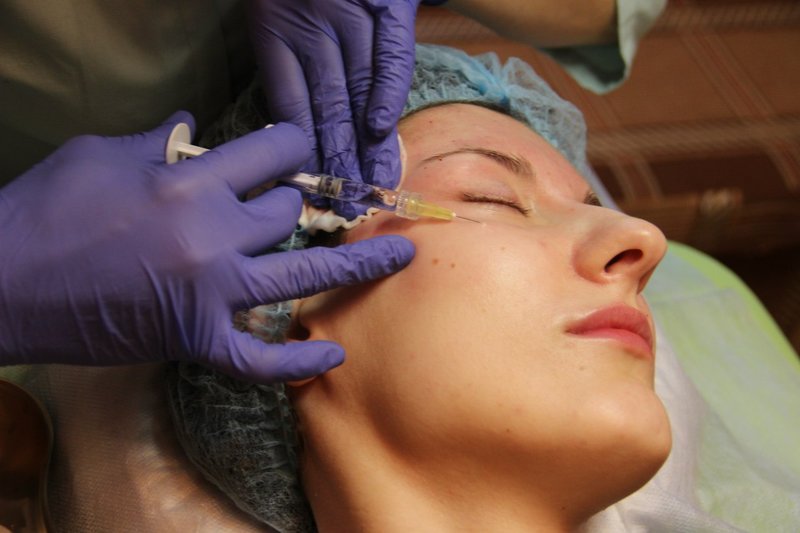 L'introduction du médicament dans la zone autour des yeux L'introduction du médicament dans la zone autour des yeux