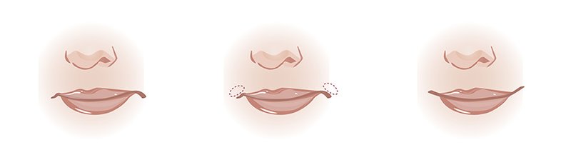 Ascenseur de coin Ascenseur de coin