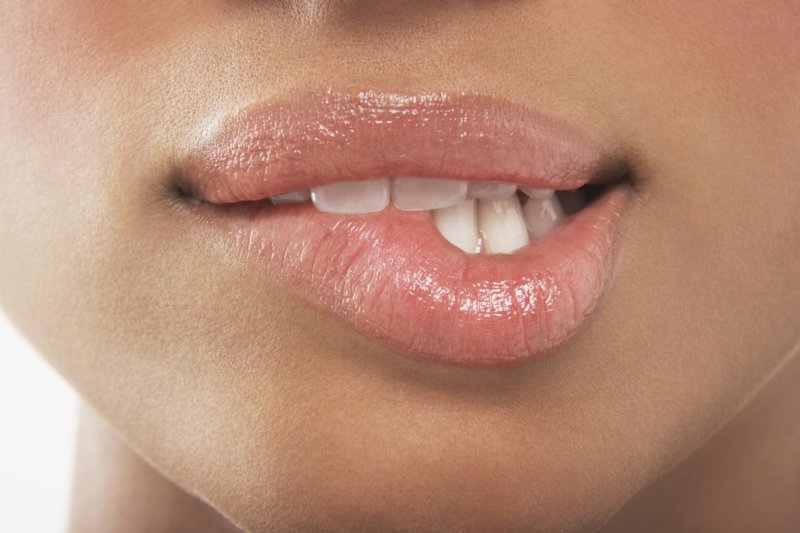 Labios después del agrandamiento del ácido hialurónico Labios