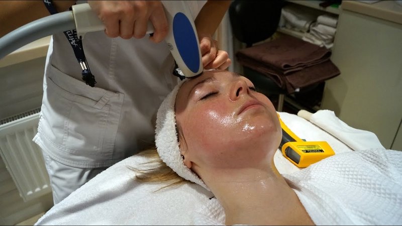 Processus de levage RF Processus de levage RF