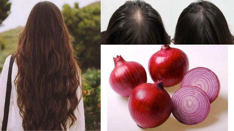 Jus d'oignon pour la restauration des cheveux Jus d'oignon pour la restauration des cheveux