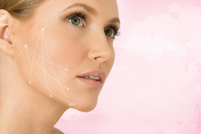 Les principaux avantages du levage SMAS Les principaux avantages du levage SMAS