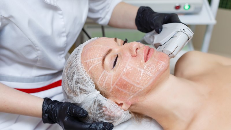 Procédure de levage Smas Procédure de levage Smas